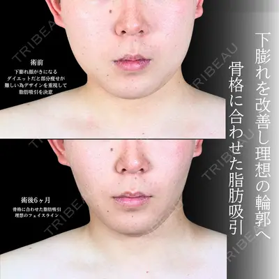アリエル美容クリニック 大宮院 鈴木　桂介医師の症例