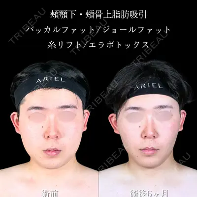 アリエル美容クリニック 大宮院 鈴木　桂介医師の症例