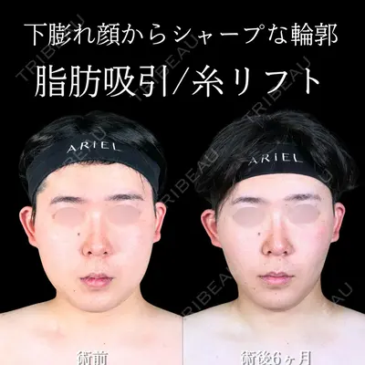 アリエル美容クリニック 大宮院 鈴木　桂介医師の症例