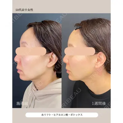 自由が丘ウェルエイジングビューティークリニック 福田 知佐子医師の症例