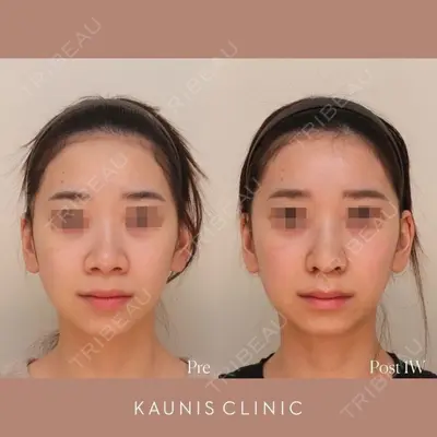 KAUNIS CLINIC（カウニスクリニック）の症例