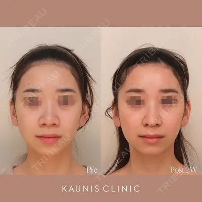 KAUNIS CLINIC（カウニスクリニック）の症例