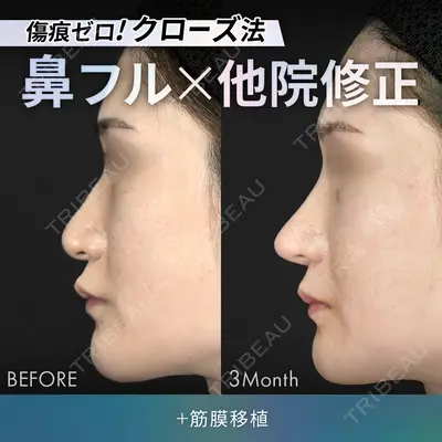 ジョウクリニック 銀座院 重本　譲医師の症例