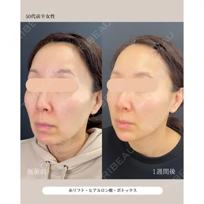 自由が丘ウェルエイジングビューティークリニック 福田 知佐子医師の症例