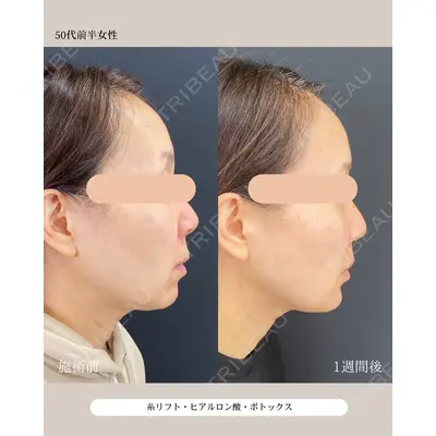 自由が丘ウェルエイジングビューティークリニック 福田 知佐子医師の症例