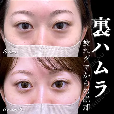 EMMO FACE CLINIC 大宮院 百瀬 直也医師の症例