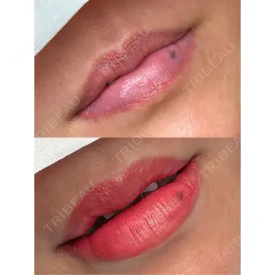 Belle Via Clinic 森田 佑望医師の症例
