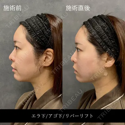 RIVER CLINIC（リバークリニック）大阪院の症例