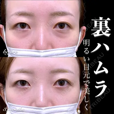 EMMO FACE CLINIC 大宮院 百瀬 直也医師の症例