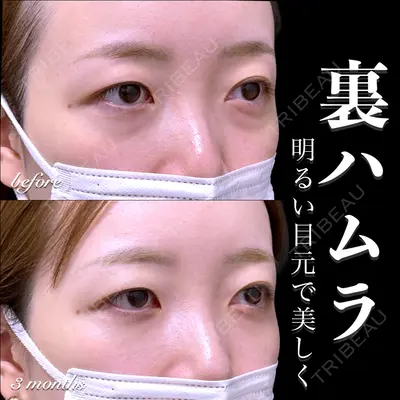 EMMO FACE CLINIC 大宮院 百瀬 直也医師の症例