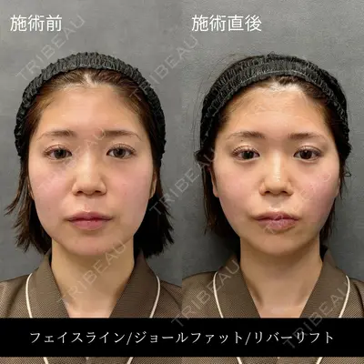 RIVER CLINIC（リバークリニック）大阪院の症例