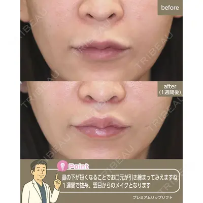 聖心美容クリニック 福岡院 美原 寿之医師の症例