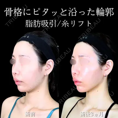 アリエル美容クリニック 大宮院 江郷隼一郎医師の症例