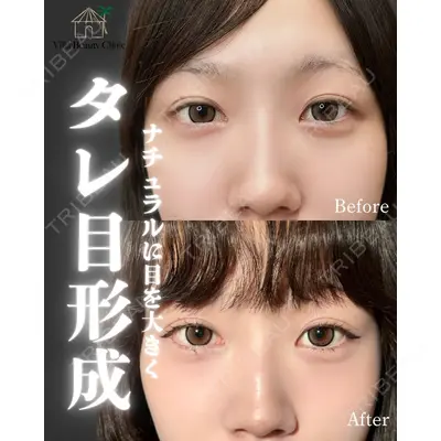 博多美容外科/美容皮膚科 ビラビューティークリニック 大村 亞蘭医師の症例