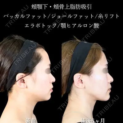 アリエル美容クリニック 大宮院 鈴木　桂介医師の症例