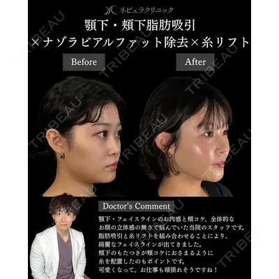 札幌美容外科ネビュラクリニック 横田 開医師の症例