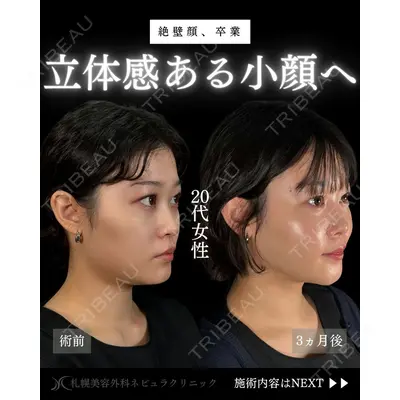 札幌美容外科ネビュラクリニック 横田 開医師の症例