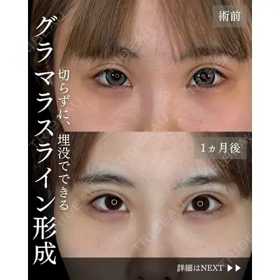 札幌美容外科ネビュラクリニック 横田 開医師の症例