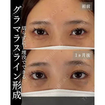 札幌美容外科ネビュラクリニック 横田 開医師の症例