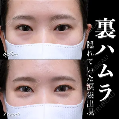 EMMO FACE CLINIC 大宮院 百瀬 直也医師の症例