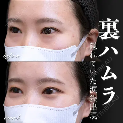 EMMO FACE CLINIC 大宮院 百瀬 直也医師の症例