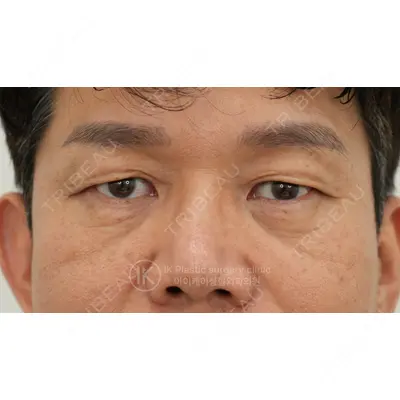 IK美容整形外科 ソン・イクヒョン医師の症例