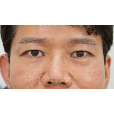 IK美容整形外科 ソン・イクヒョン医師の症例