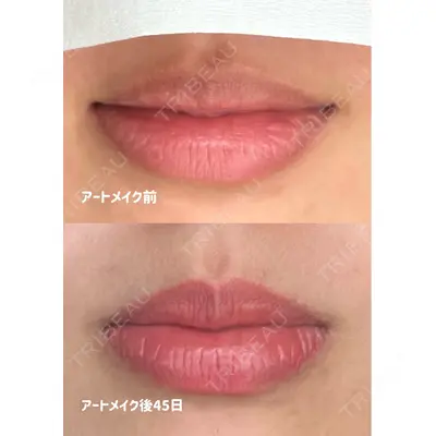 Belle Via Clinic 森田 佑望医師の症例