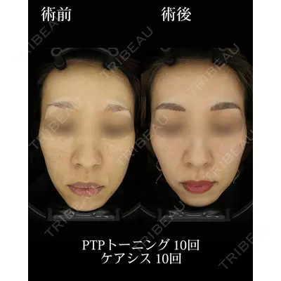 HAAB BEAUTY CLINIC 名古屋院の症例