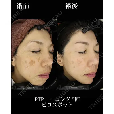 HAAB BEAUTY CLINIC 名古屋院の症例