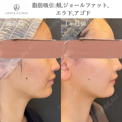 LOUIS CLINIC 二子玉川院【ルイクリニック】 小松 塁医師の症例