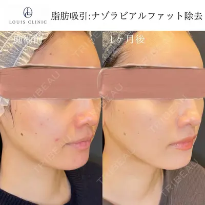 LOUIS CLINIC 二子玉川院【ルイクリニック】 小松 塁医師の症例