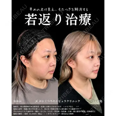 新宿美容外科ネビュラクリニック 山本 紘子医師の症例
