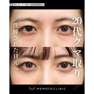 MEMOTO CLINIC 名古屋 鈴木 大路医師の症例