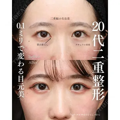 MEMOTO CLINIC 名古屋 鈴木 大路医師の症例