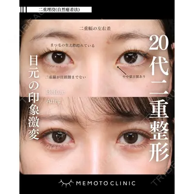 MEMOTO CLINIC 名古屋 鈴木 大路医師の症例