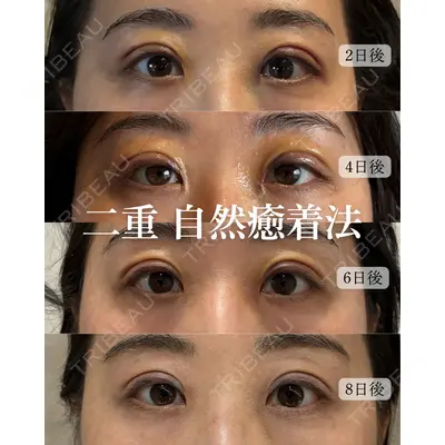 nico wellness デンタルクリニック広尾 佐藤 大晟医師の症例