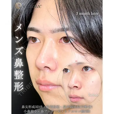 eクリニック 福岡院 伊藤 渉医師の症例