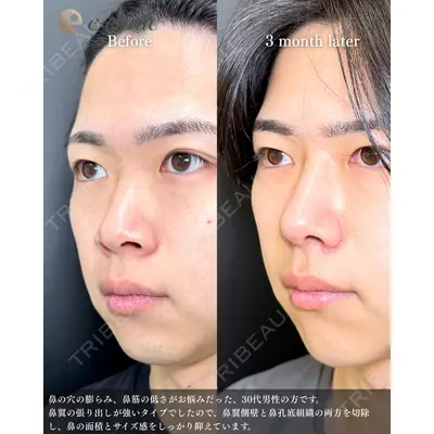 eクリニック 福岡院 伊藤 渉医師の症例