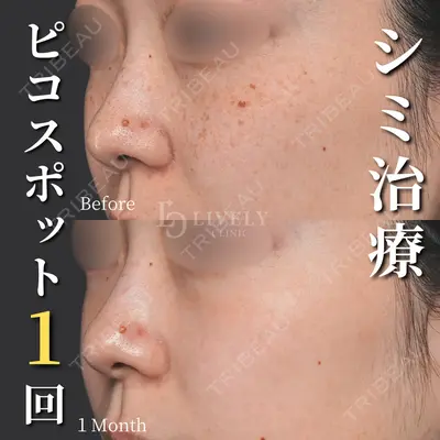 ライブリークリニック 浜松町院 林 政男医師の症例