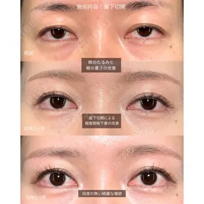 PRISM Beauty Clinic 町田院 森本 理一郎医師の症例