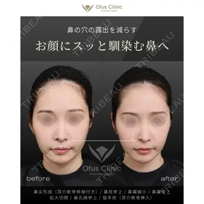 Otus Clinic 【オータスクリニック】 中 徳太郎医師の症例