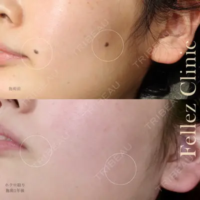 Fellez Clinic【フェルズクリニック】の症例