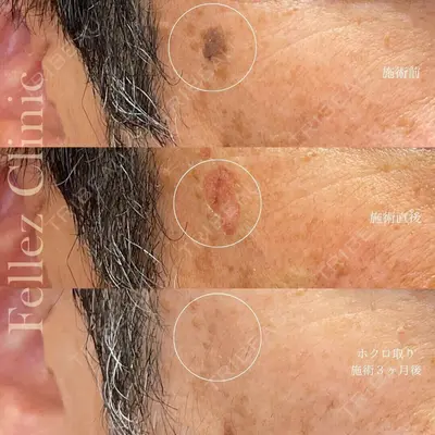 Fellez Clinic【フェルズクリニック】の症例