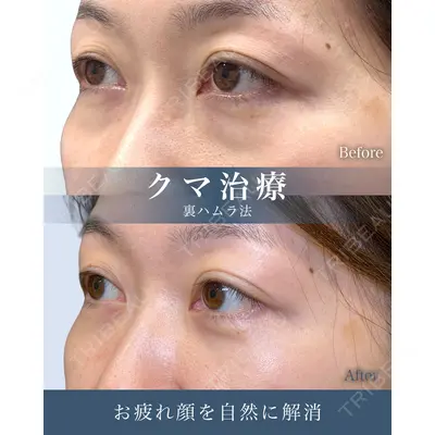 eクリニック 横浜みなとみらい院 坂本 優衣医師の症例