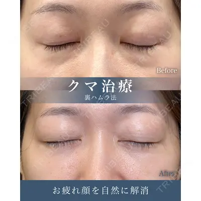 eクリニック 横浜みなとみらい院 坂本 優衣医師の症例