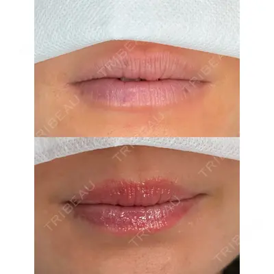 Belle Via Clinic 森田 佑望医師の症例