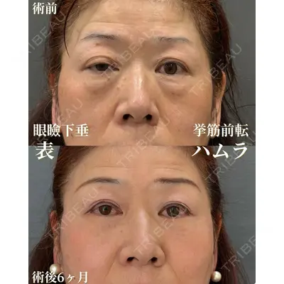 お茶の水美容形成クリニック 吉井 健吾医師の症例