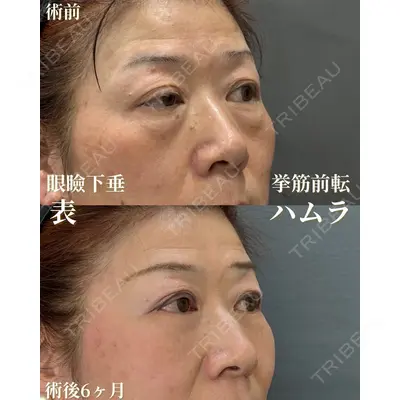 お茶の水美容形成クリニック 吉井 健吾医師の症例