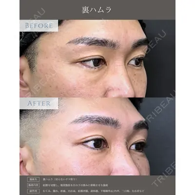 eクリニック 新宿院 相原 隆充医師の症例